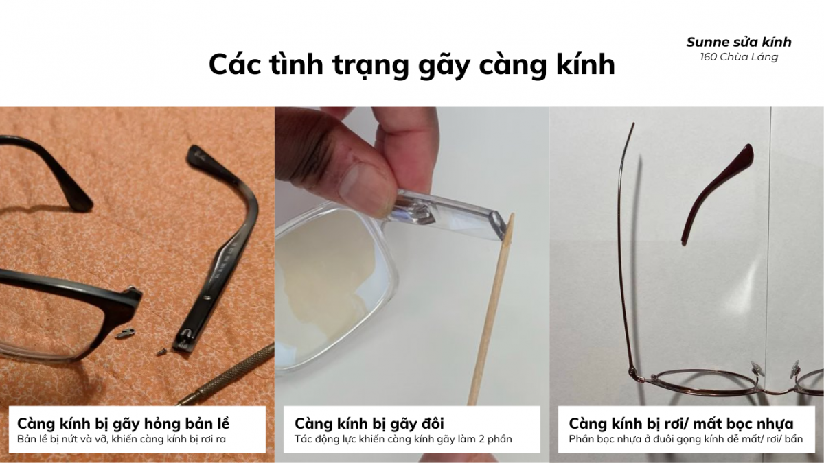 Các tình trạng càng kính bị gãy thường gặp