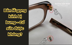Bản lề gọng kính bị bung – Có sửa được không?