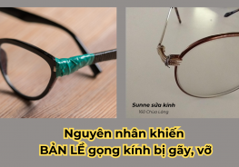 Nguyên nhân khiến bản lề gọng kính bị gãy, vỡ