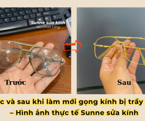 Trước và sau khi làm mới gọng kính bị trầy xước – Hình ảnh thực tế Sunne sửa kính