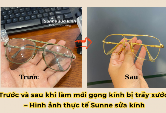 Trước và sau khi làm mới gọng kính bị trầy xước – Hình ảnh thực tế Sunne sửa kính