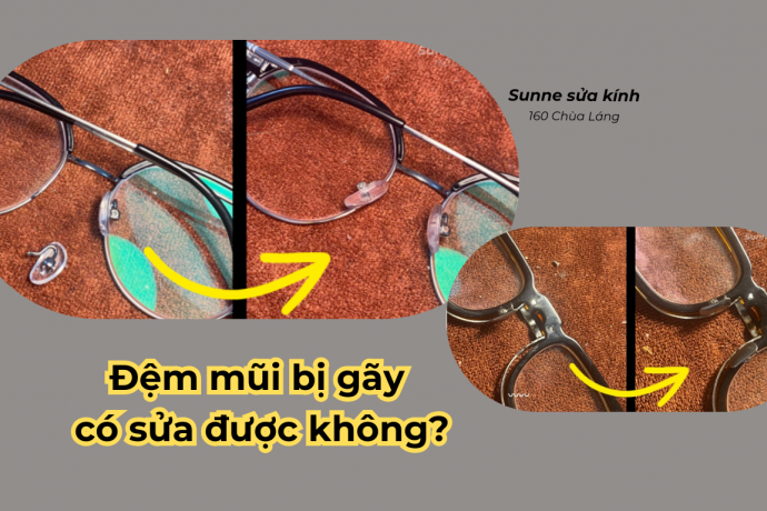 Đệm mũi bị gãy có sửa được không? Dịch vụ sửa Đệm mũi bị gãy hỏng số 1 Hà Nội